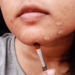 दाग-धब्बों और एक्ने छिपाने के लिए सही करेक्टर का करे चुनाव