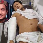 पवनदीप राजन की भयानक एक्सीडेंट के बाद पहली बार सामने आई तस्वीर