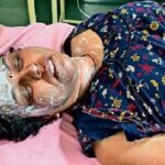 शिवपुरी में महिला टेलर ने पार्षद के घर पर पेट्रोल छिड़ककर आग लगाई, पार्षद और टेलर दोनों झुलस गए