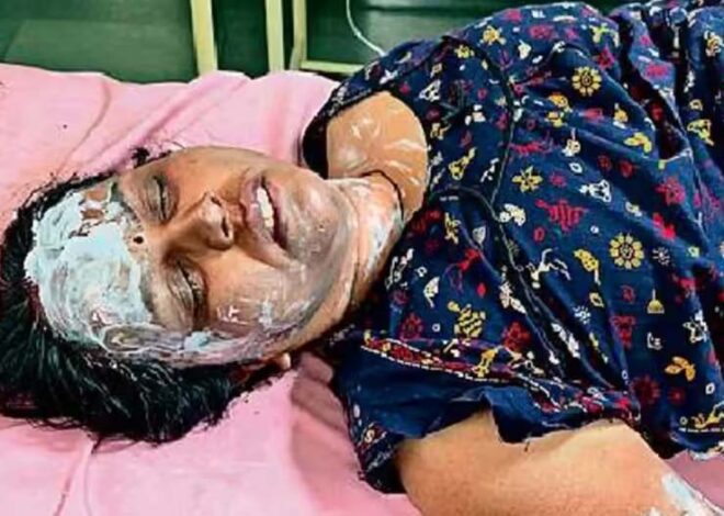 शिवपुरी में महिला टेलर ने पार्षद के घर पर पेट्रोल छिड़ककर आग लगाई, पार्षद और टेलर दोनों झुलस गए